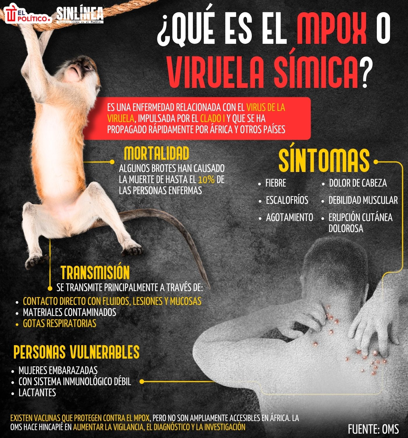 Infografía qué es la viruela símica o mpox