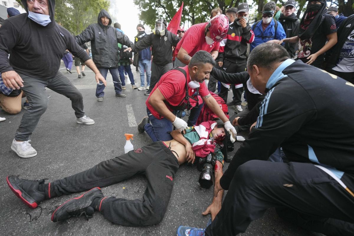 Gobierno de Milei deja gravemente herido a un fotógrafo