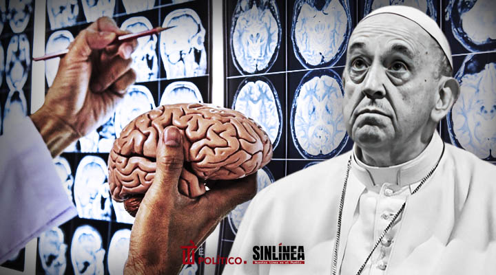 Ictus cerebral, la causa de muerte del papa Francisco