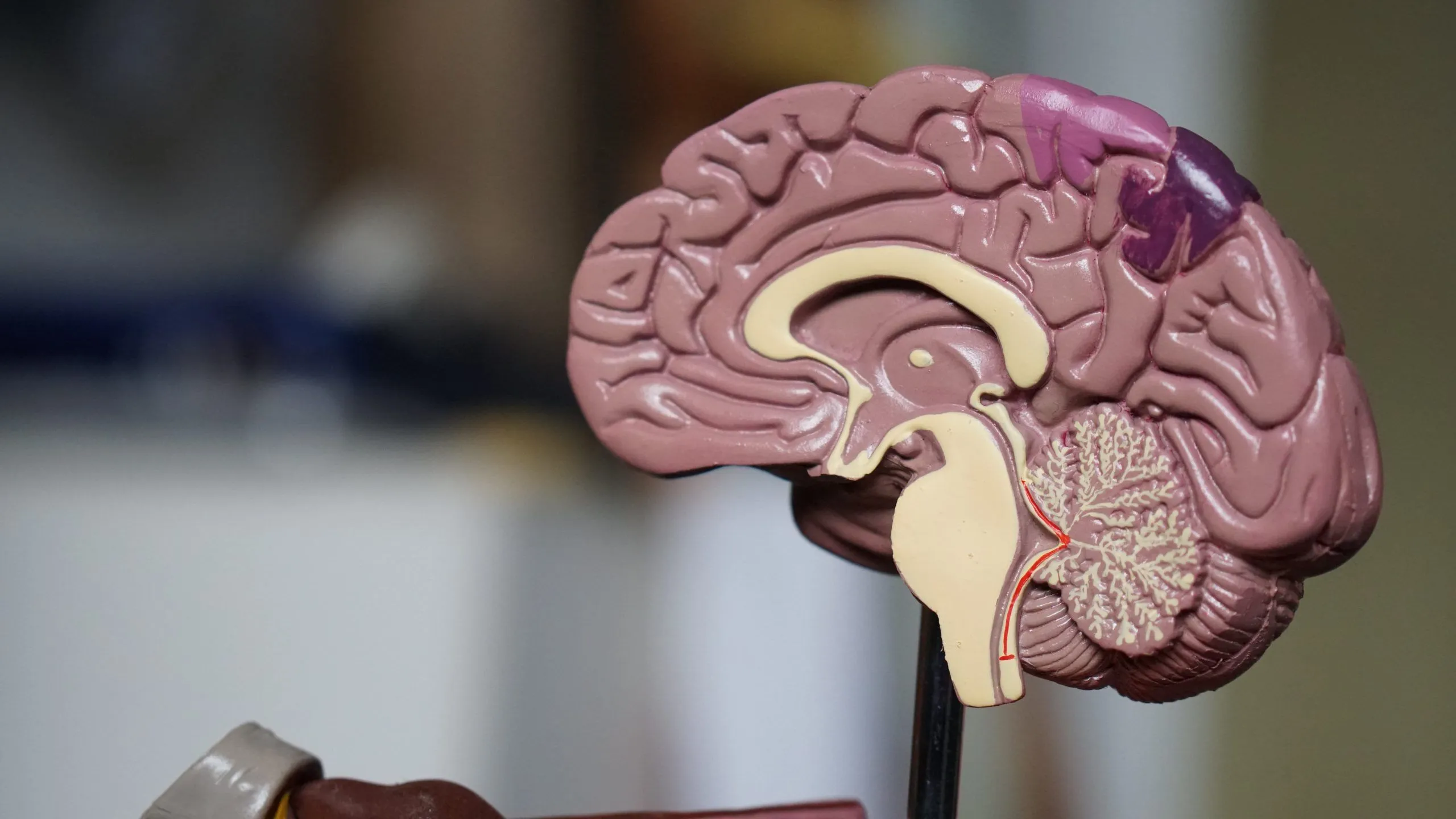 Ictus cerebral qué es