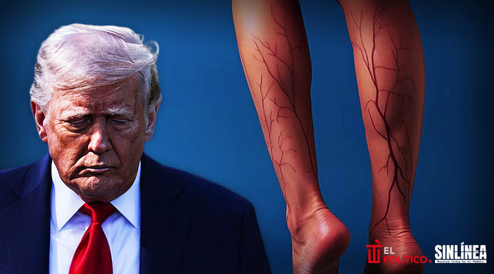 Trump enfermedad