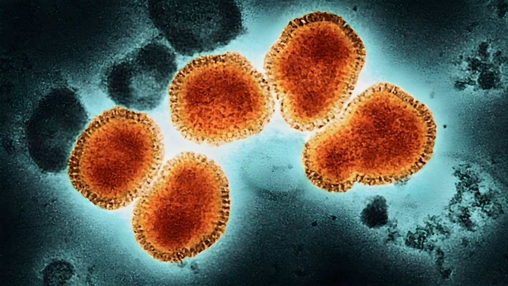 Confirman primer caso de influenza A H3N2 en México